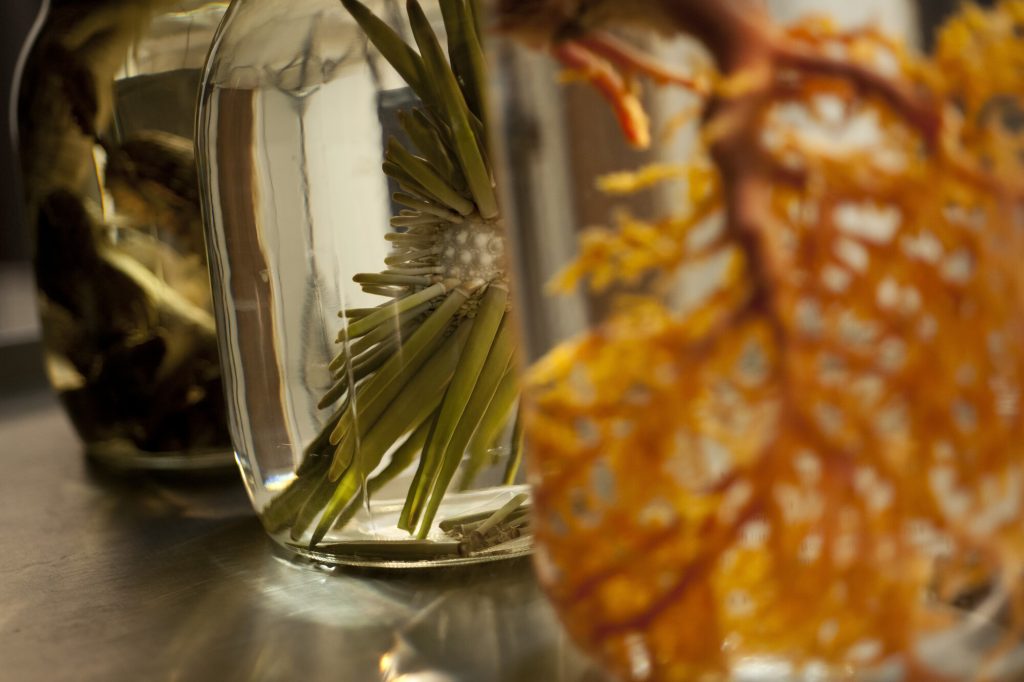a set of three large jars with different marine organisms lie sea urchins and the center one is in focus only