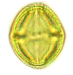 microscopic pollen grain