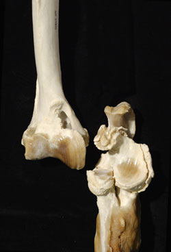 Panther knee joint