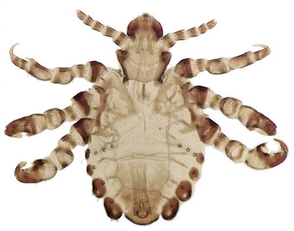 Pthirus Gorrilae