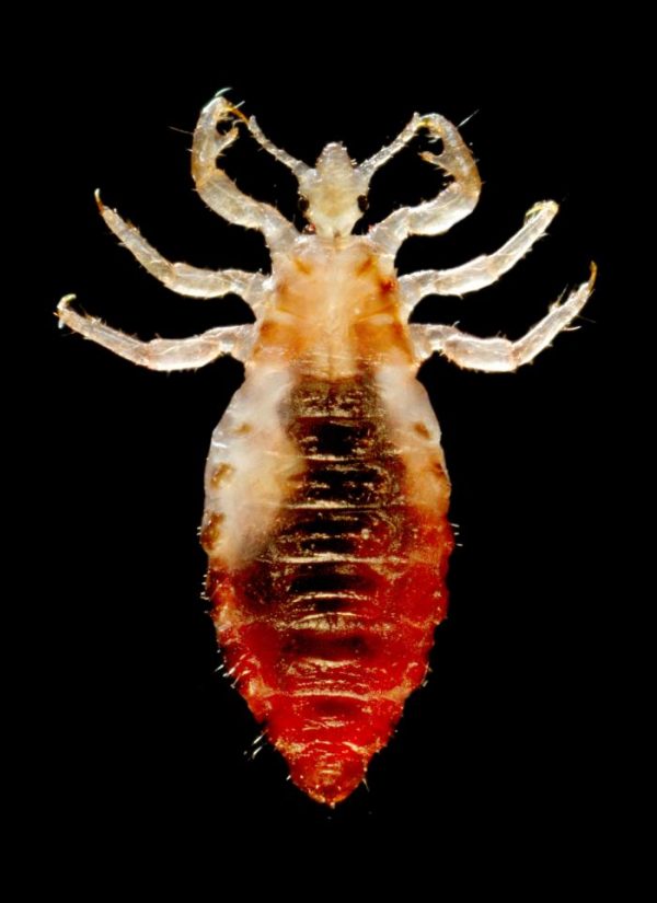 Body louse