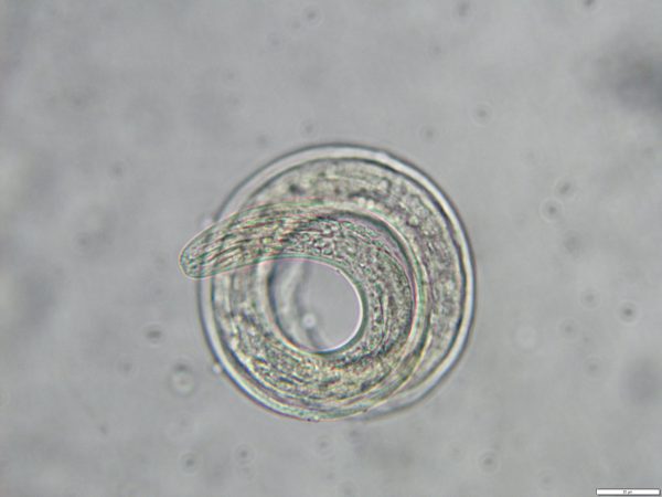 rat lungworm larvae