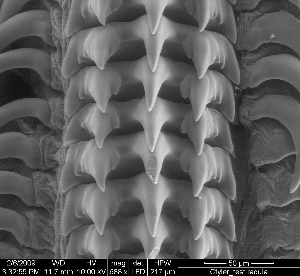 microscopic view of tiny snail teeth