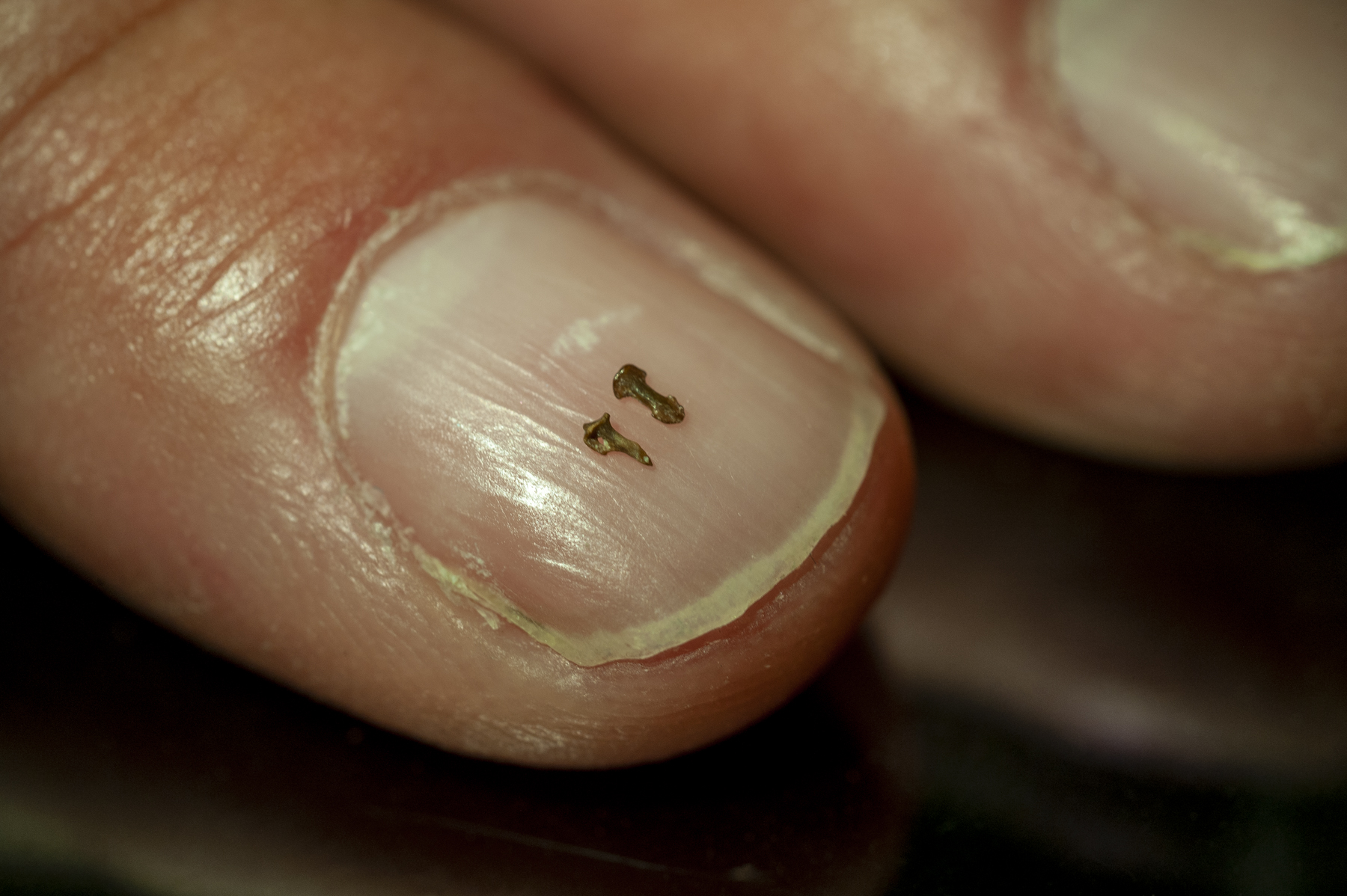 Fingernail Pain Symptoms, Causes & Common Questions | Buoy