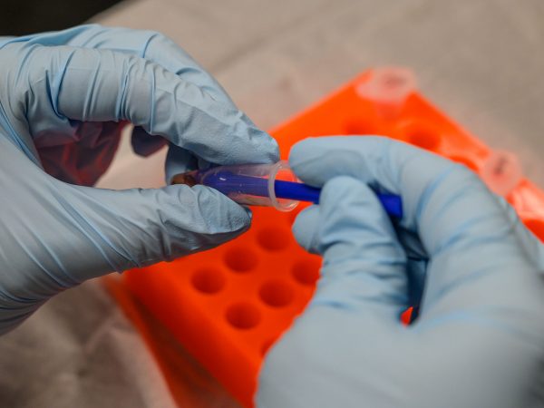 gloved hands preparing specimen in DNA lab