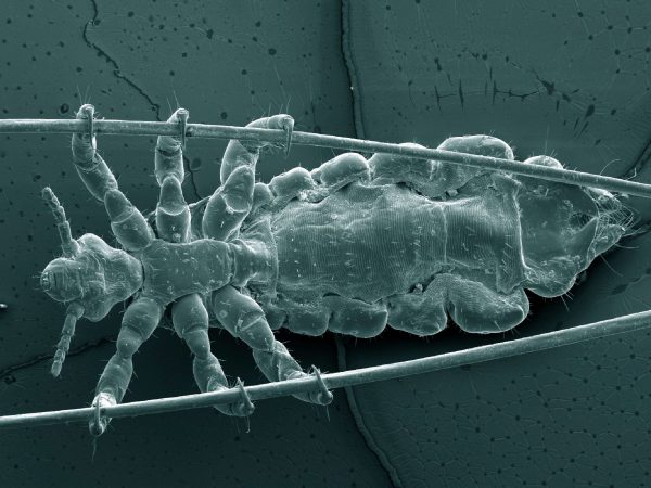 Electron micrograph of a head louse clinging to two hairs.