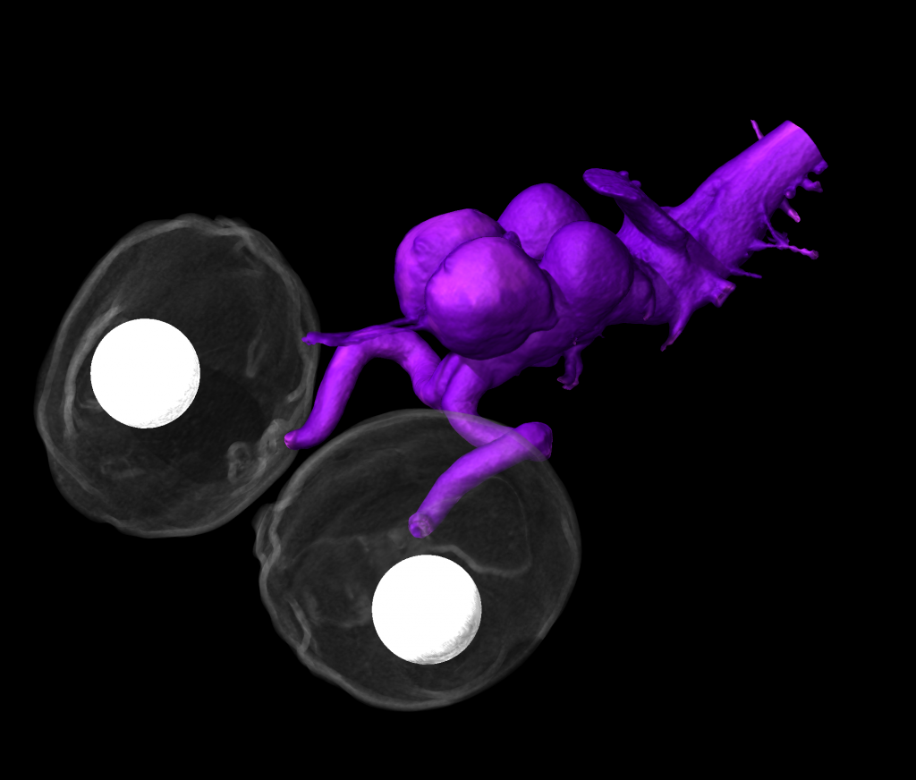 3D scan of a chameleon's brain with nerves connecting to eyes in white.
