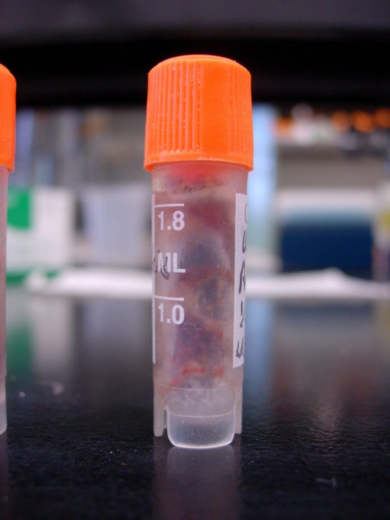 plastic viel with tissue samples