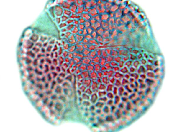 photo of Pollen of the Gentian family