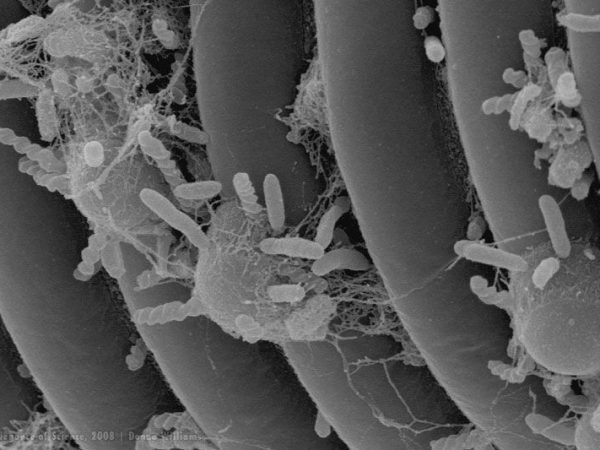 magnified nematode and parasites