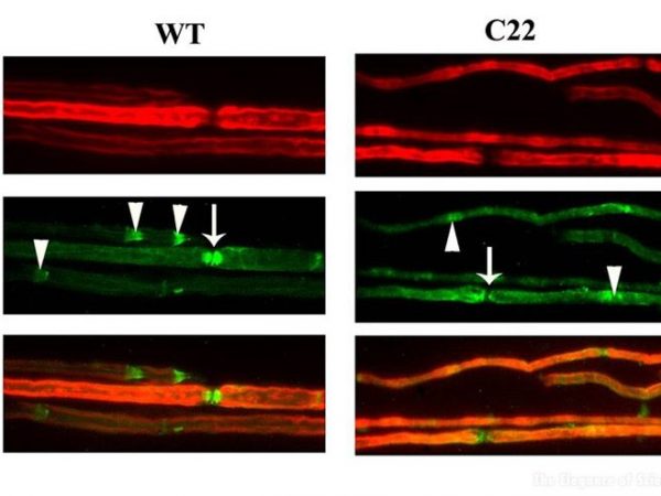 stained cells of nerves