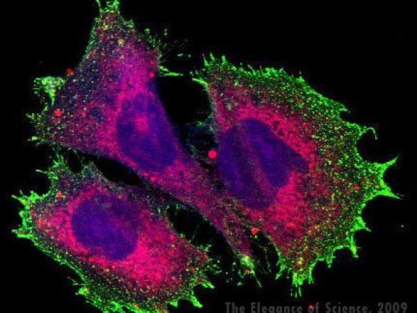 magnification of stained tissue cells