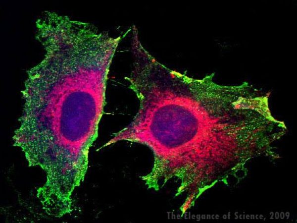 magnification of stained tissue cells