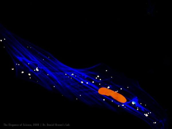 Alligator lung tissue with bacteria