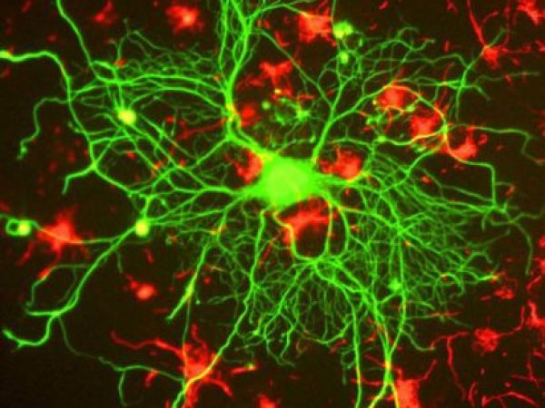 A neuron from an adult rat