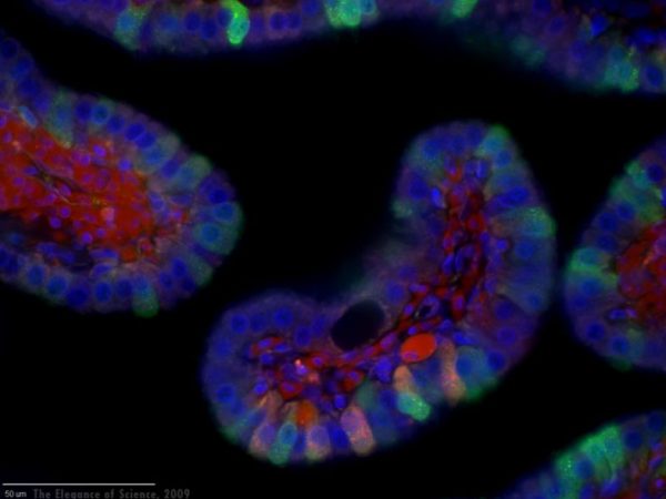 magnification of two combined viruses
