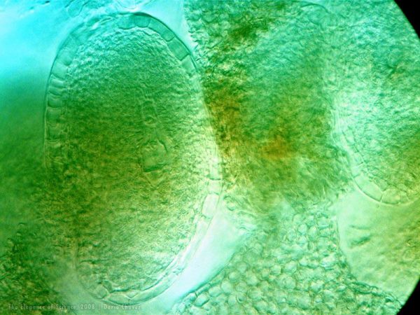 magnified blueberry ovule