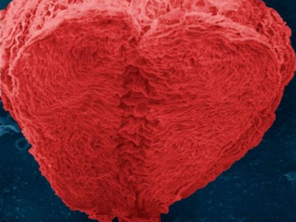 magnified pollen shaped like a heart