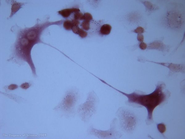 magnification of stained mice tissue