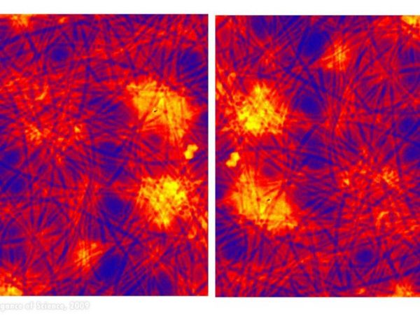 magnification of stained L. monocytogenes