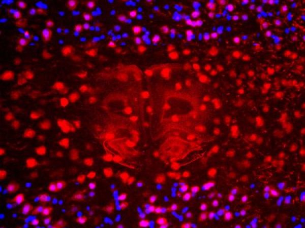Two-image overlay of magnified brain tissue