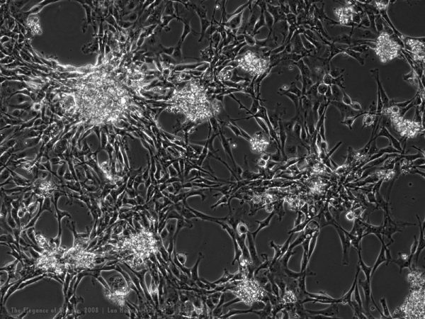 magnified animal neuronal cells