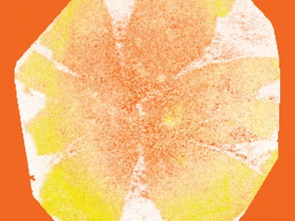 magnified eye tissue