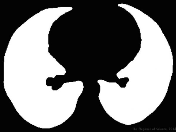 lung volume map from x-ray