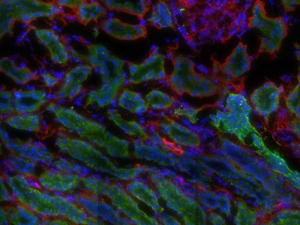 tissue from a rhesus macaque