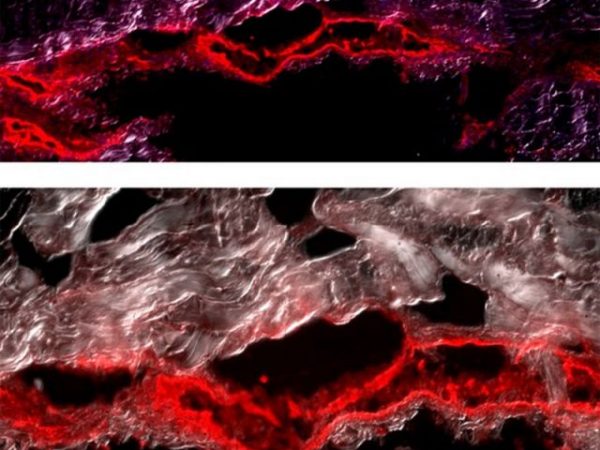 magnification of cow tissue