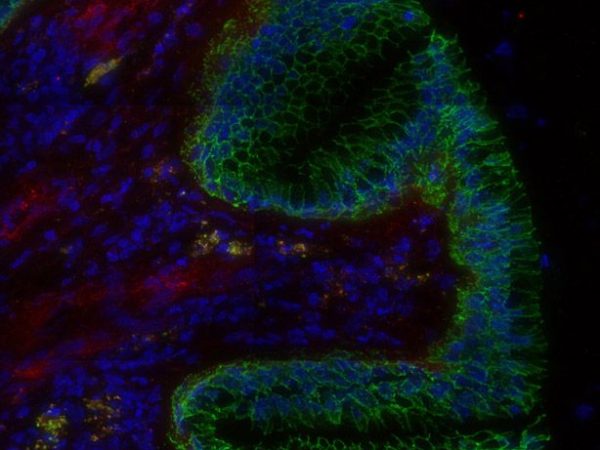 tissue from a rhesus macaque