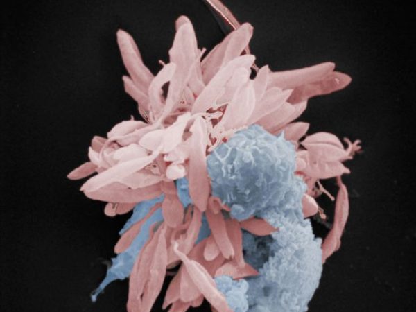 magnified cells and parasitic infection