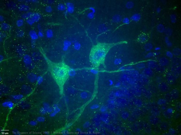 adult human stem cells