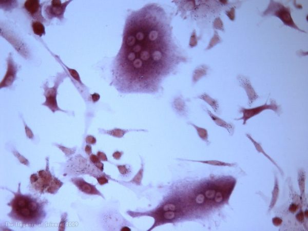 magnification of stained mice tissue