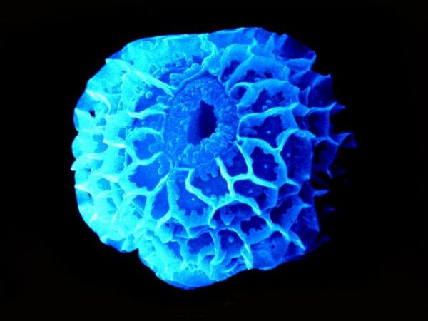magnified grain of pollen