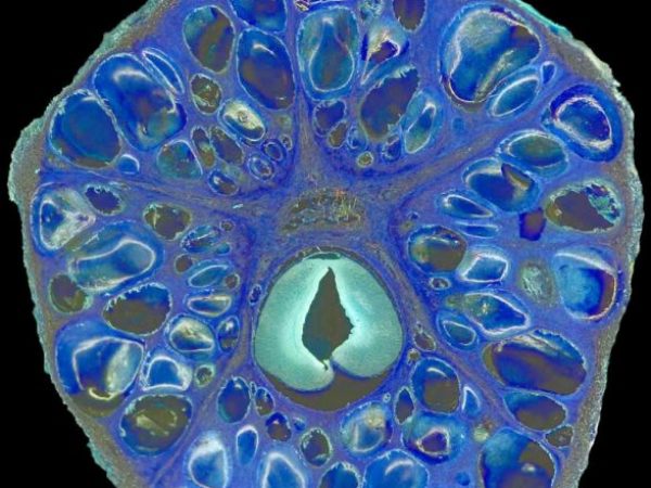 Transversal section of a fruit