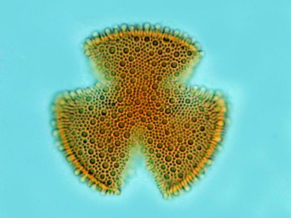 magnified image of a single grain of the pollen