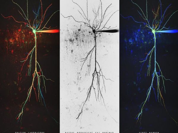 three images of a mouse neuron