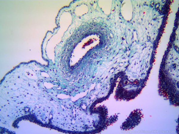 Creation and Destruction: The Development of the Chicken Embryonic Membranes, Jacob Fyda