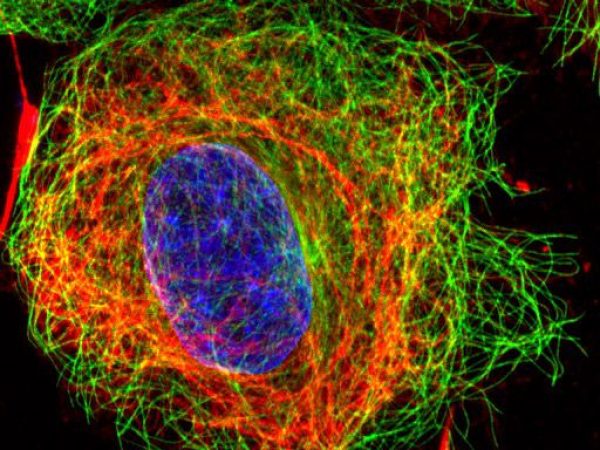 fluorescence micrograph of protein structure