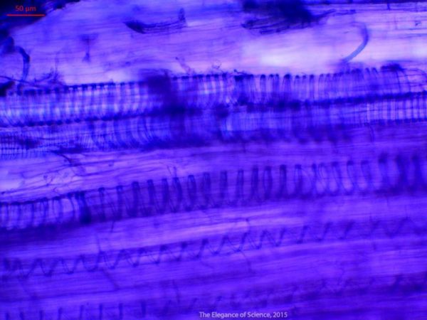 magnified celery tissue
