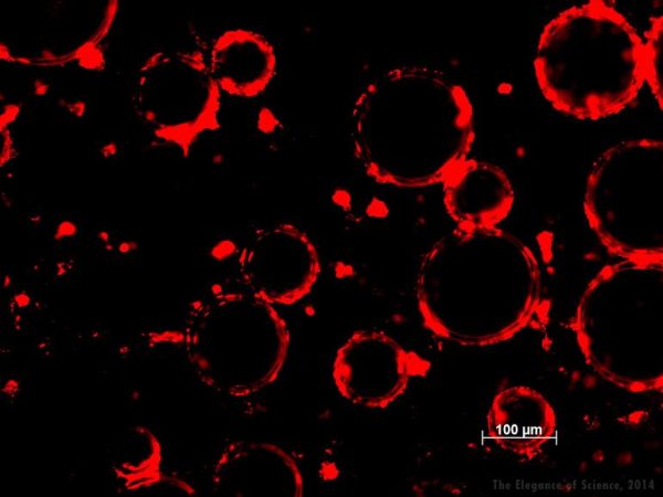 magnification of cartilage