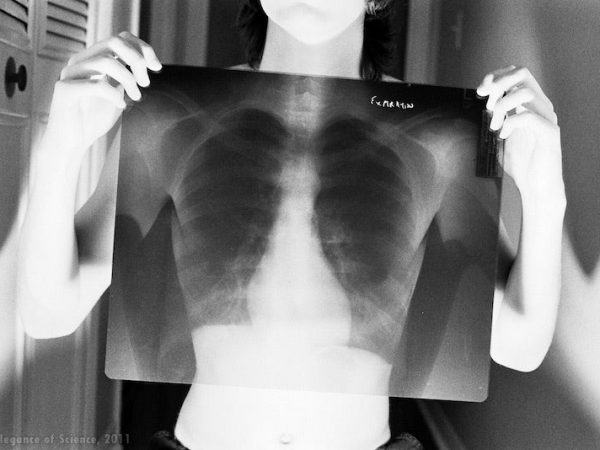 self portrait with chest x-ray