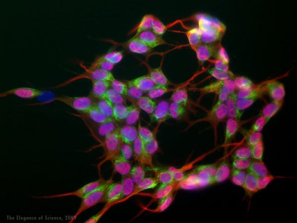 magnification of stained cells