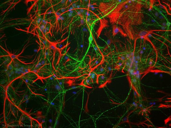 magnification of stained rat neurons