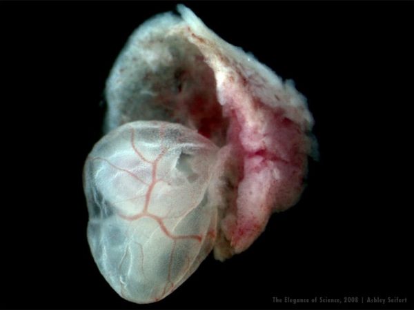 mouse embryo