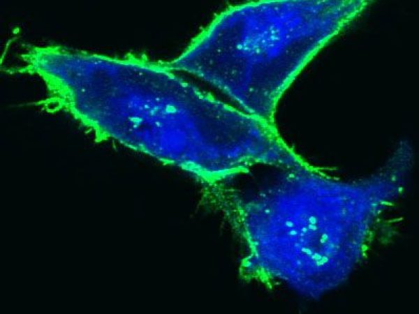 magnification of stained cells