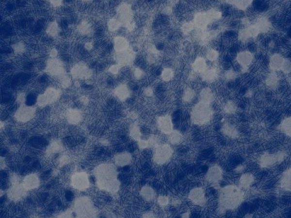 negative stain of human foodborne pathogen, 'L. monocytogenes'