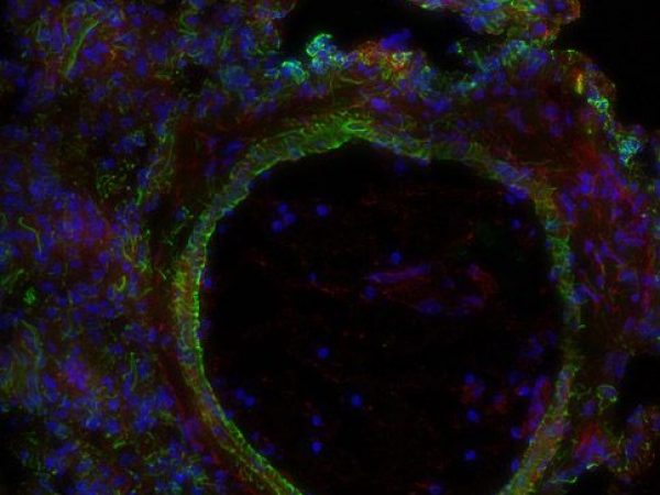 tissue of a rhesus macaque