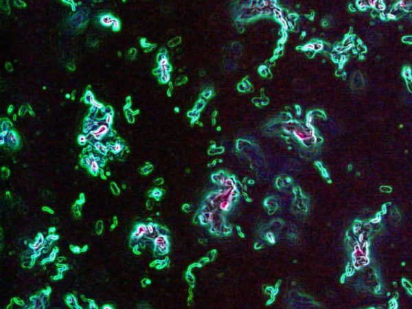 flagella of pathogen Listeria monocytogenes